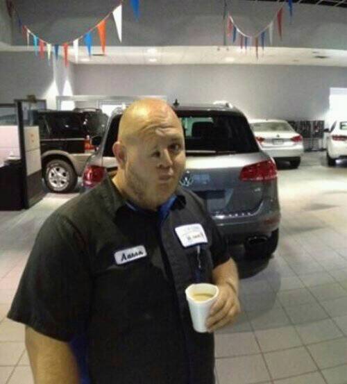 Gương mặt của người đàn ông này đã bị biến dạng không mong muốn