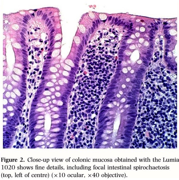 Vi ảnh chụp từ Nokia Lumia 1020