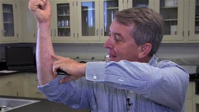 Muỗi đốt đầy tay