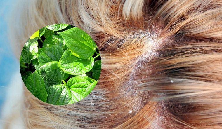 Chi tiết hơn 18 cách trị trứng tóc tại nhà không thể bỏ qua 4 Hé lộ 4 cách chữa bệnh nấm tóc hiệu quả bằng phương pháp dân gian