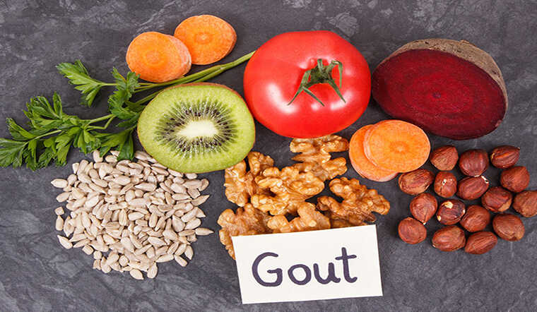 Bệnh gút là gì? 10 thực phẩm tốt cho người bệnh gout