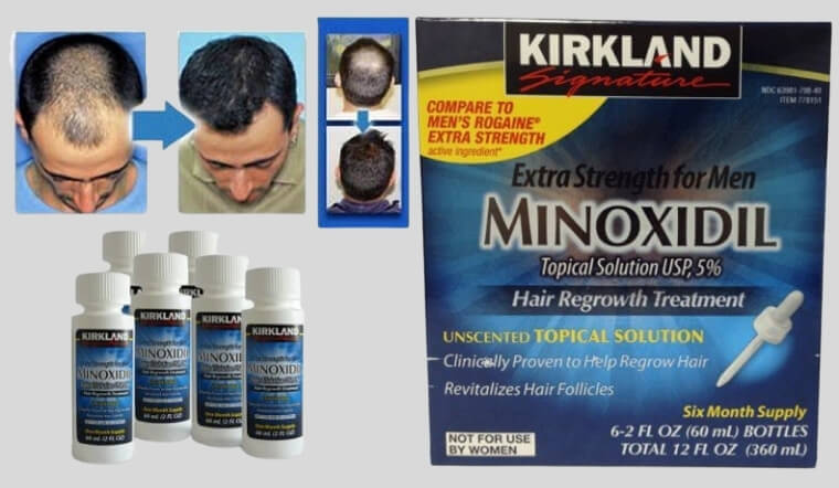 Kem mọc tóc Rogaine Minoxidil 5 Foam cho Nam bộ 3 chai 60ml 3  Shopee  Việt Nam