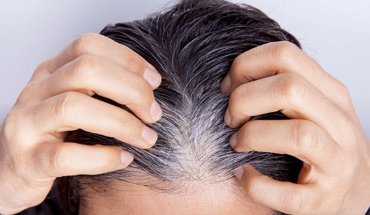 Cách điều trị và nguyên nhân dẫn đến hiện tượng tóc bạc sớm ở trẻ
