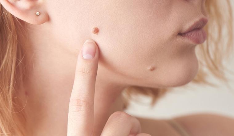 Xem bói nốt ruồi trên khuôn mặt phụ nữ - Tử Vi Số Mệnh
