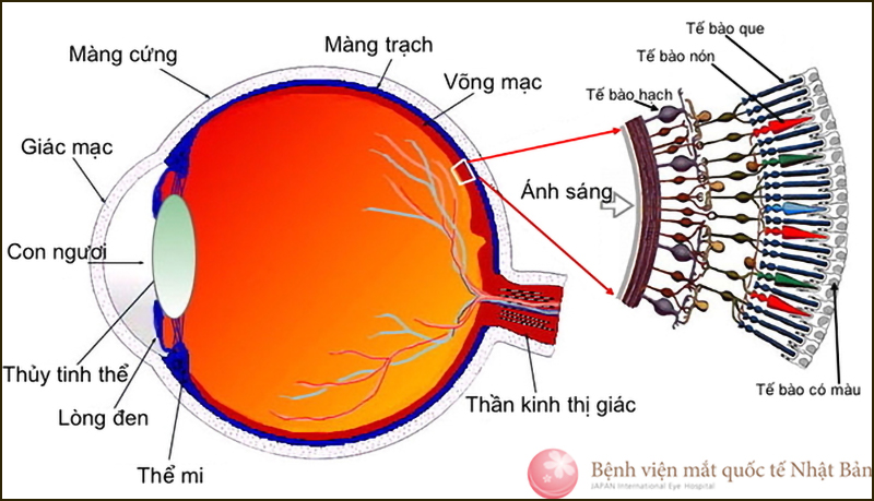 Đối với người bị cận thị, tia sáng khi đi qua mắt sẽ hội tụ ở trước võng mạc thay vì hội tụ ở đúng vị trí như mắt bình thường