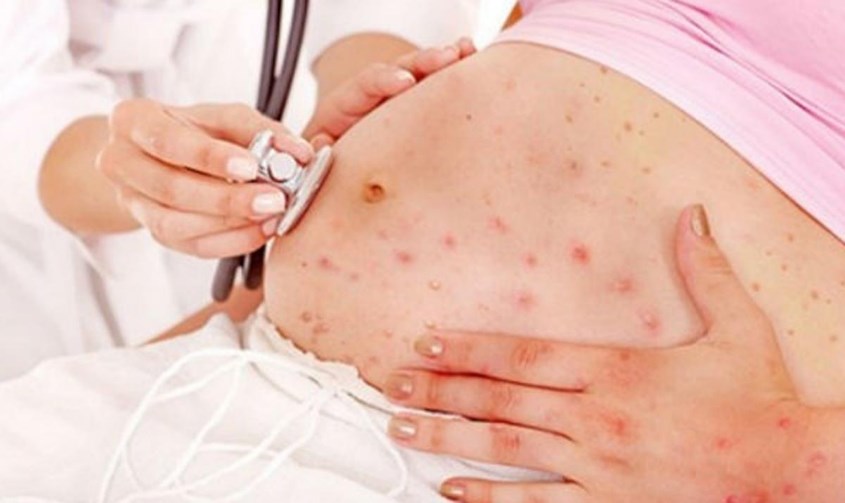 lưu ý khi uống sữa óc chó