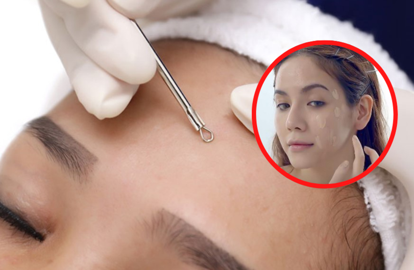 Tránh trang điểm sau khi nặn mụn