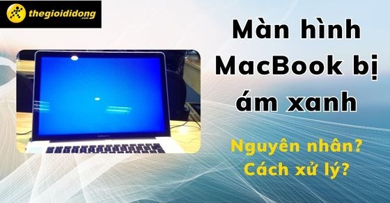 Màn hình MacBook bị ám xanh, ố vàng: Nguyên nhân, cách xử lý hiệu quả