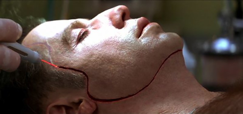 Trong "Face/Off", nhân vật của John Travolta đã phải phẫu thuật thay đổi gương mặt để truy tìm kẻ thù