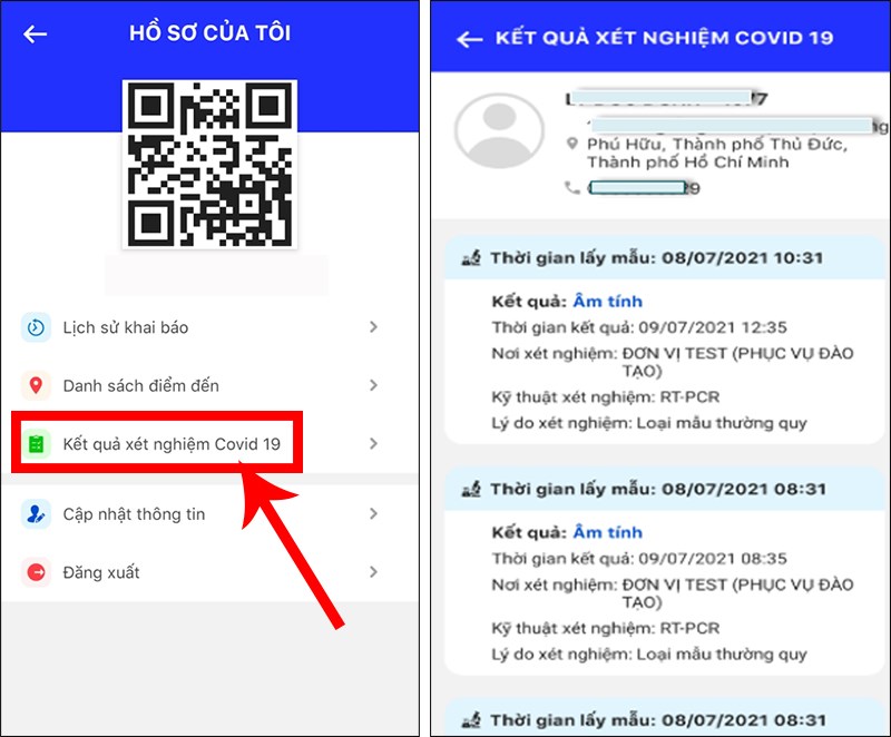 Chọn mục Kết quả xét nghiệm Covid 19 để xem kết quả