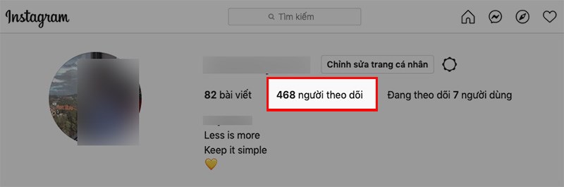 Chọn Người theo dõi