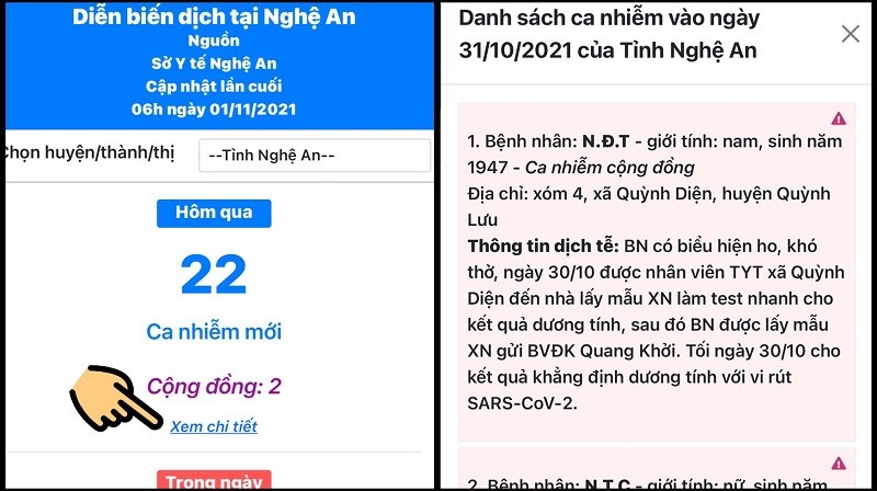 Nhấn Xem chi tiết 
