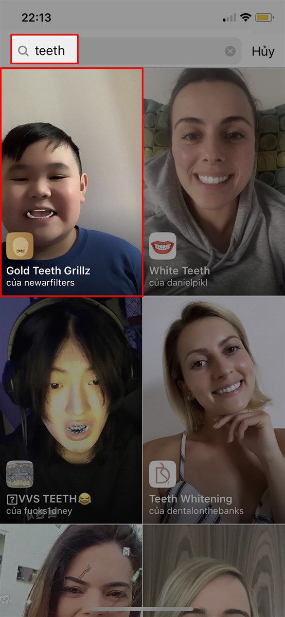 Nhập từ kh&oacute;a teeth v&agrave; chọn filter niềng răng Instagram m&agrave; bạn muốn sử dụng