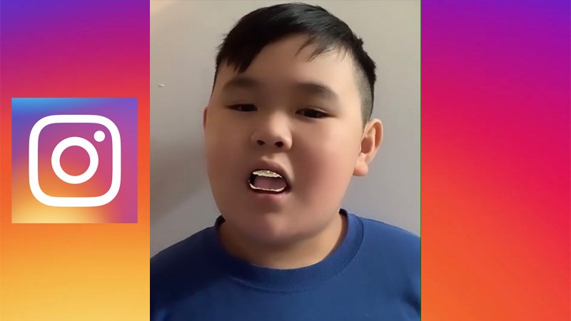 C&aacute;ch quay video filter niềng răng tr&ecirc;n Instagram nhanh, đơn giản