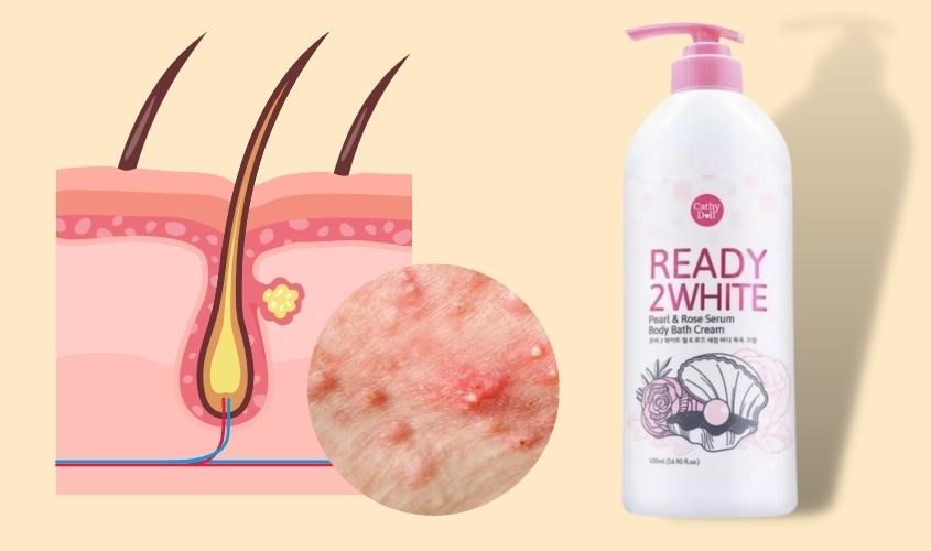 Sữa tắm Cathy Doll Ready 2 White hương hoa hồng 500 ml chống viêm lỗ chân lông