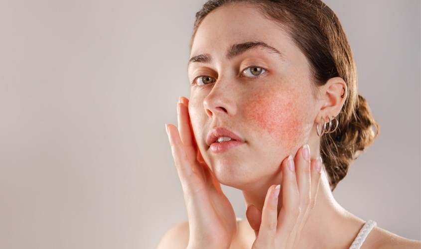 Thành phần của serum cần lành tính, an toàn cho da nhạy cảm