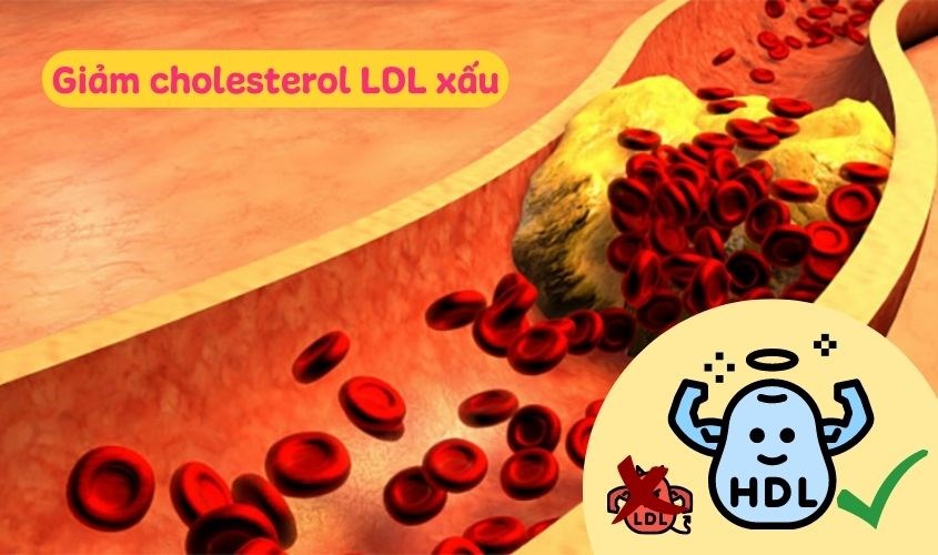 Lecithin giúp làm giảm lượng cholesterol LDL xấu và tăng lượng cholesterol HDL tốt trong máu