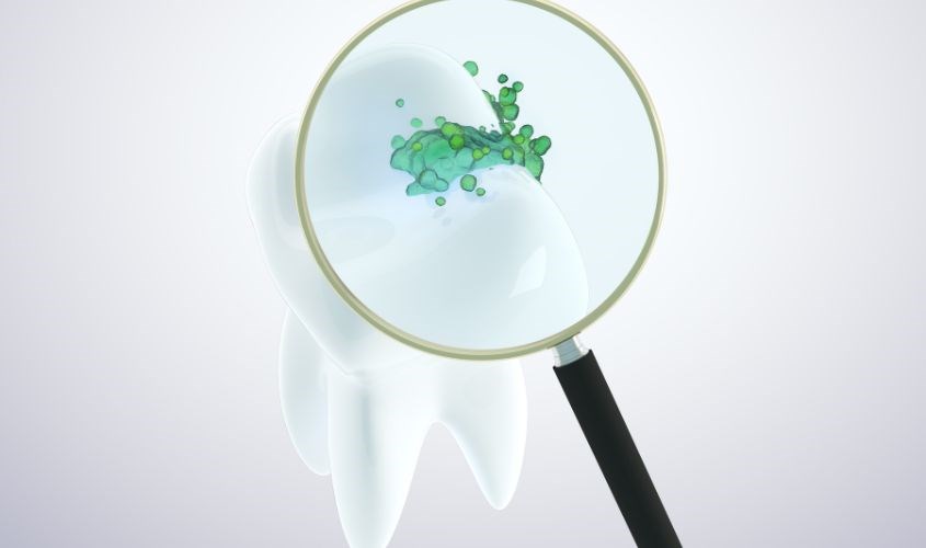 Các vấn đề do răng miệng có thể dẫn đến hơi thở có mùi