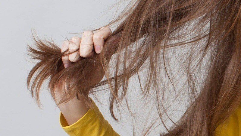 Rụng tóc, tóc mỏng Rụng tóc, tóc mỏng có thể do mất cân bằng nội tiết tố nữ