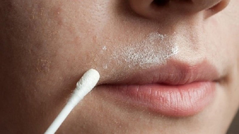 Mọc lông sẫm màu ở môi, cằm và ngực Mọc lông sẫm màu ở môi, cằm và ngực