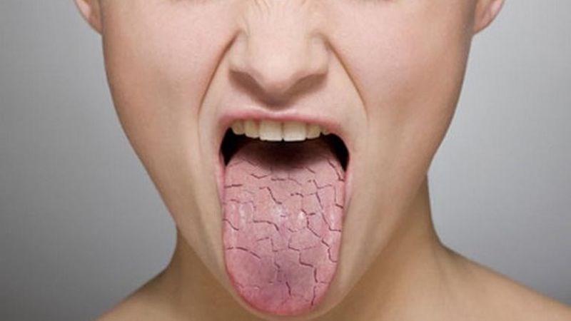 Khô miệng là tác dụng phụ phổ biến.