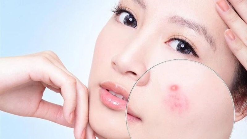 Da của bạn có thể bị kích ứng khi dùng sữa rửa mặt không phù hợp