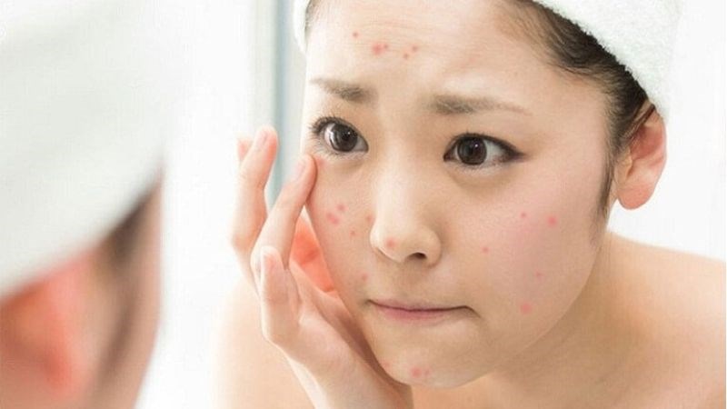 Bạn không nên rửa mặt quá lâu khiến làn da bị kích ứng, nổi mụn