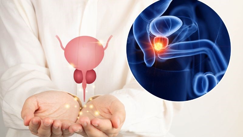 Ung thư tiền liệt tuyến có liên quan đến liều dùng omega-3
