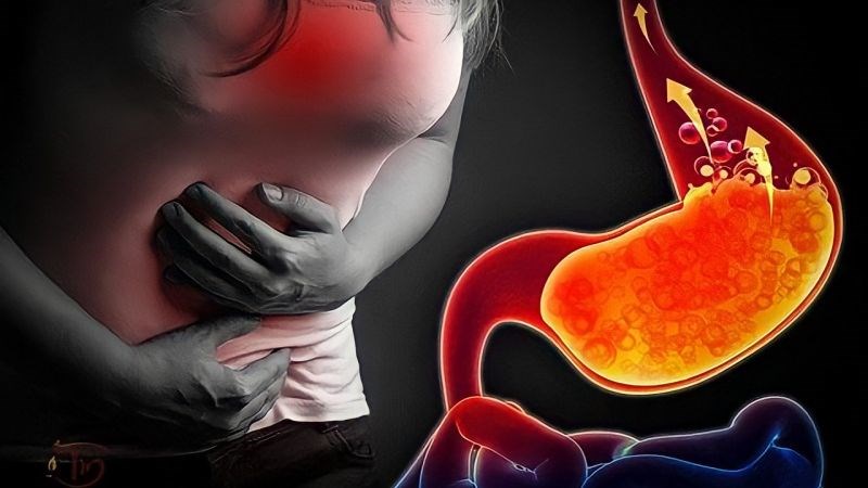 Trào ngược acid là một trong những tác dụng phụ trên đường tiêu hóa của dầu cá