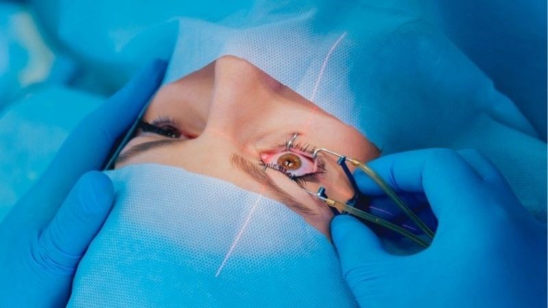 Mí mắt có dấu hiệu sụp xuống sau các ca phẫu thuật