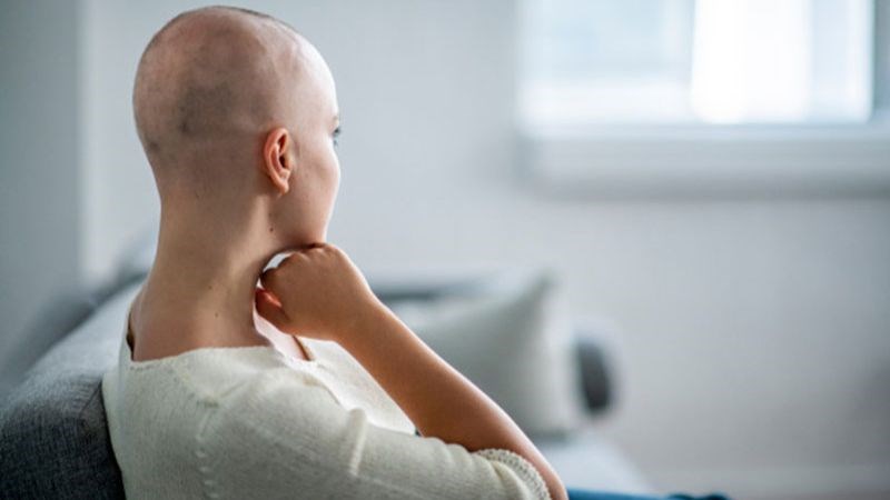 Sau khoảng 2 đến 4 tuần bệnh nhân xạ trị thường gặp hiện tượng rụng tóc