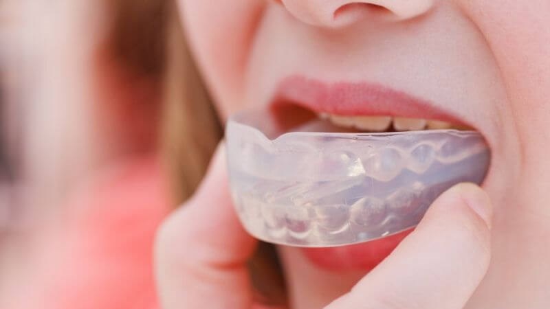 Bạn có thể dùng dụng cụ ngậm miệng để giảm ngưng thở trong ngủ ngáy