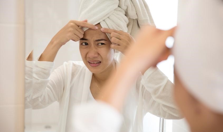Không nên tự nặn mụn ẩn tại nhà
