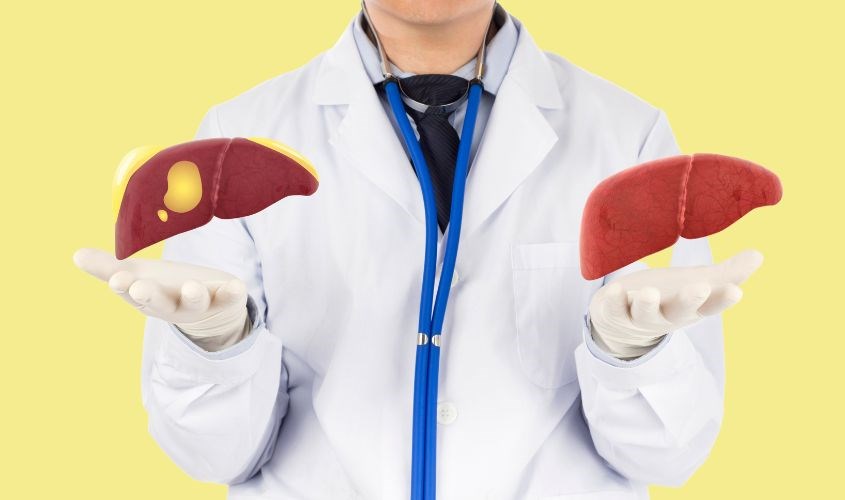 Người bị xơ gan sẽ khiến bệnh thêm nặng nếu dùng mật ong Người bị xơ gan sẽ khiến bệnh thêm nặng nếu dùng mật ong