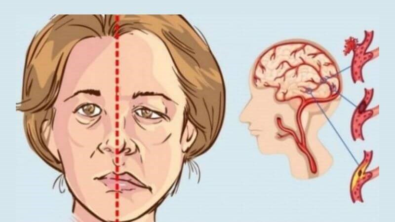 M&eacute;o miệng l&agrave; dấu hiệu cần đến gặp b&aacute;c sĩ sớm