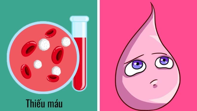 Máu kinh nguyệt màu hồng có thể là do thiếu máu. Máu kinh nguyệt màu hồng có thể là do thiếu máu.