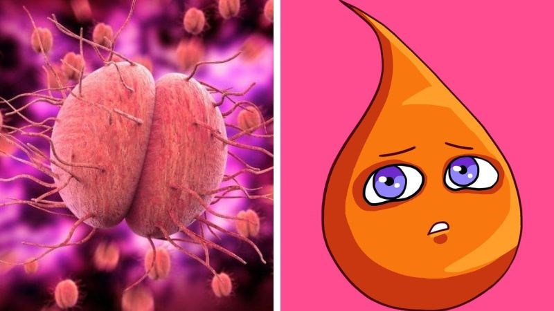 Máu kinh nguyệt màu cam có thể là do mắc bệnh lây truyền qua đường tình dục. Máu kinh nguyệt màu cam có thể là do mắc bệnh lây truyền qua đường tình dục.