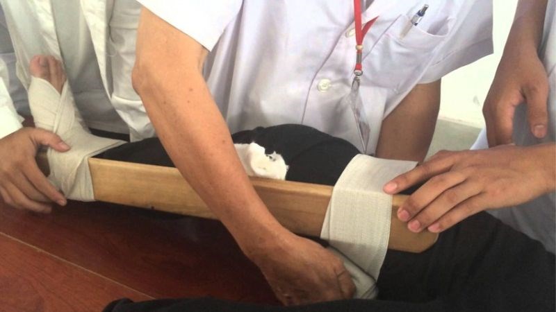 Cố định vị trí bị thương di chuyển nạn nhân cẩn thận