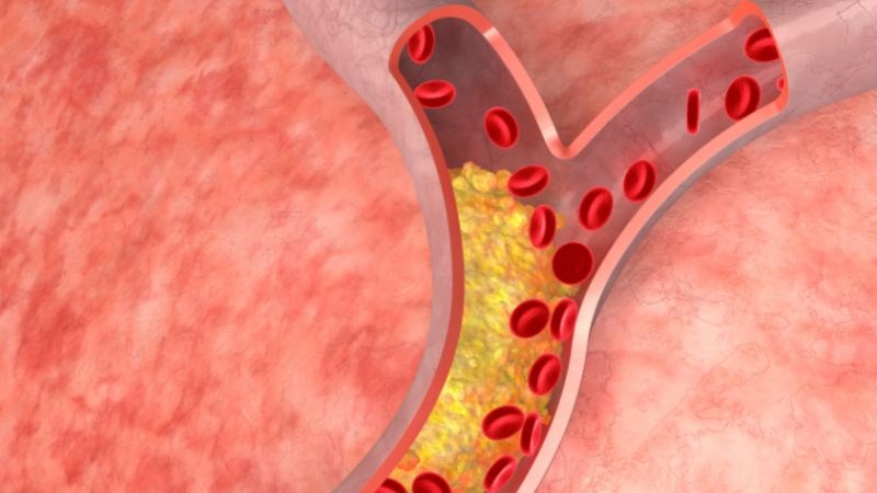 Ăn yến mạch giúp giảm cholesterol