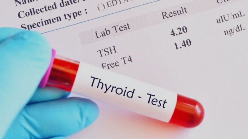 Xét nghiệm máu để kiểm tra nồng độ hormone