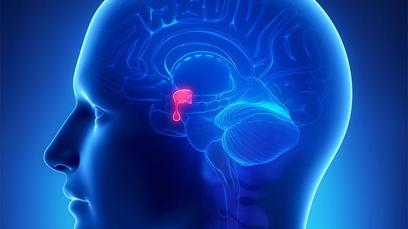 Tuyến yên không sản xuất đủ hormone kích thích tuyến giáp (TSH)