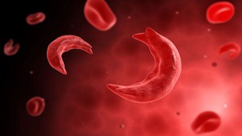 Bệnh thiếu máu hồng cầu lưỡi liềm di truyền từ cha/mẹ sang con