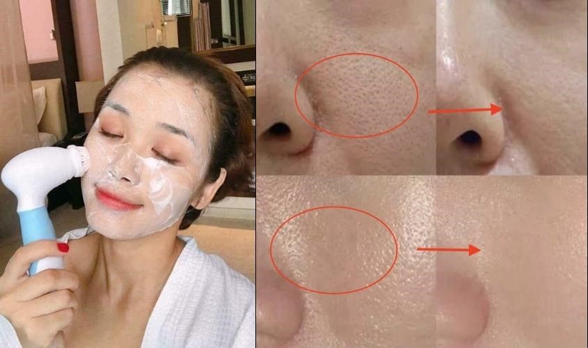 Cọ rửa mặt giúp lấy đi bụi bẩn và thu nhỏ lỗ chân lông Cọ rửa mặt giúp lấy đi bụi bẩn và thu nhỏ lỗ chân lông