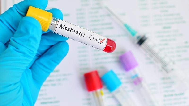 Xét nghiệm chẩn đoán nhiễm virus Marburg