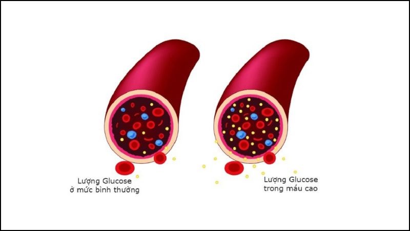 Ăn kim chi giúp ổn định đường huyết