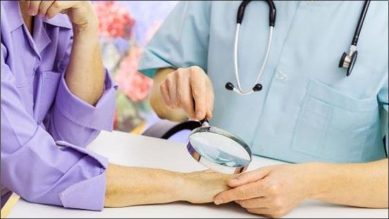 Nên đến gặp bác sĩ khi có dấu hiệu bong tróc móng 