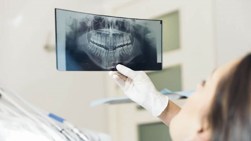 Chụp  phim X-quang răng toàn cảnh giúp phát hiện vị trí và nguyên nhân gây bệnh