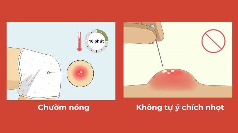 Chăm sóc da đúng cách giúp tăng hiệu quả điều trị Chăm sóc da đúng cách giúp tăng hiệu quả điều trị