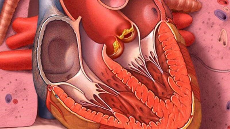 Những người mắc các loại bệnh sau không nên uống tinh bột nghệ Những người mắc các loại bệnh sau không nên uống tinh bột nghệ
