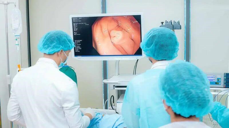 Nội soi tiêu hóa giúp bác sĩ phát hiện các tổn thương do vi khuẩn lao gây ra tại đường ruột